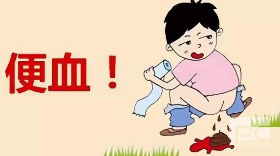 运城众泰肛肠医院：痔疮出血可以自愈吗？