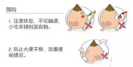 运城众泰肛肠医院：如何判断肛裂病情?