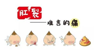 运城众泰肛肠医院：什么样的肛裂需要手术？