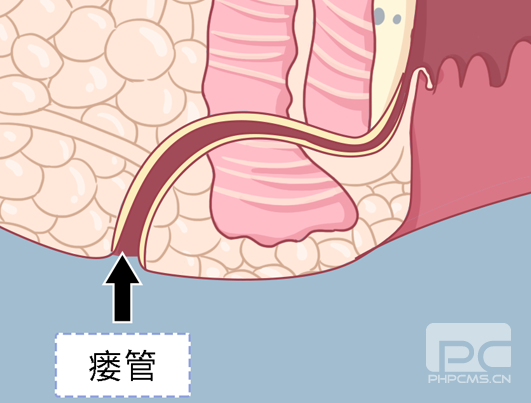 运城众泰肛肠医院：肛周瘙痒、破溃、流脓？千万别拖！