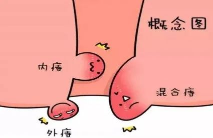 运城众泰肛肠医院：肛门坠胀同时又便秘是怎么回事？