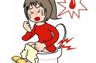 运城众泰肛肠医院：经常便血饮食上要注意些什么?