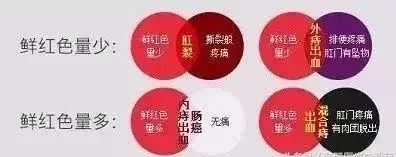 运城众泰肛肠医院:无痛性便血的原因,你了解吗?