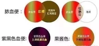 运城众泰肛肠医院:无痛性便血的原因,你了解吗?
