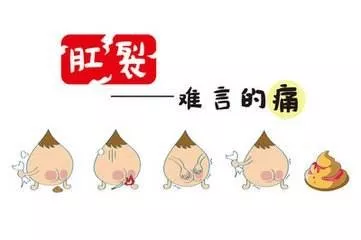 运城众泰肛肠医院：肛裂！病情可轻可重